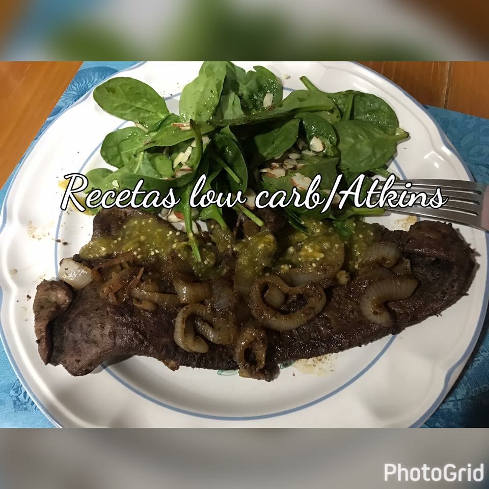 Hígado Encebollado